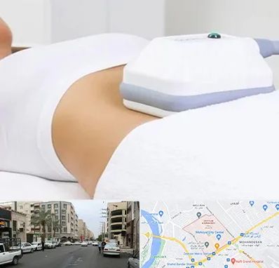 لاغری موضعی در زیتون کارمندی اهواز 