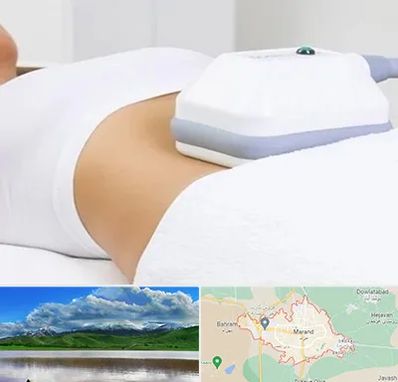 لاغری موضعی در مرند