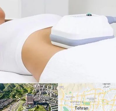 لاغری موضعی در شمال تهران 