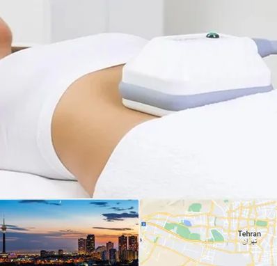 لاغری موضعی در غرب تهران 