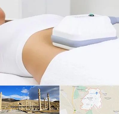 لاغری موضعی در مرودشت