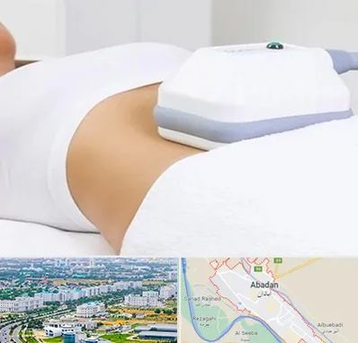 لاغری موضعی در آبادان