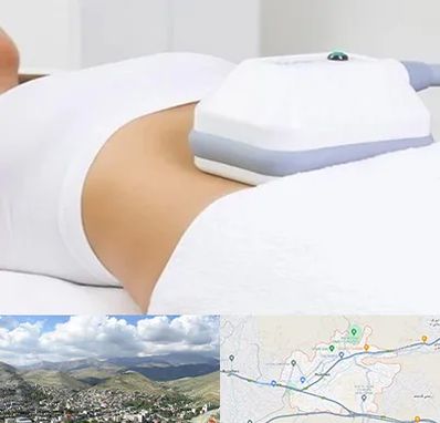 لاغری موضعی در رودهن