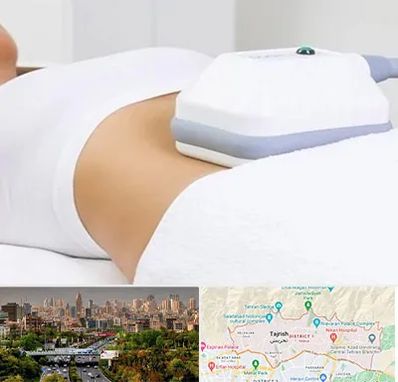 لاغری موضعی در منطقه 1 تهران 