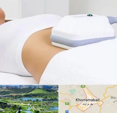 لاغری موضعی در خرم آباد