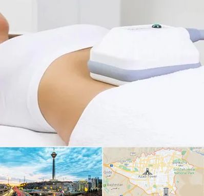 لاغری موضعی در تهران