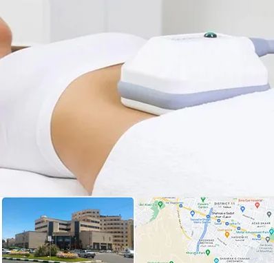 لاغری موضعی در صیاد شیرازی مشهد 