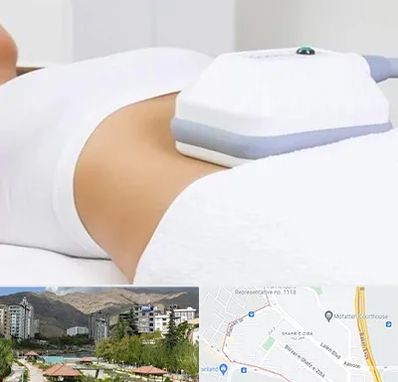 لاغری موضعی در شهر زیبا 