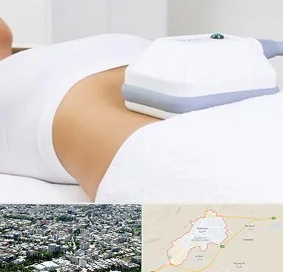 لاغری موضعی در شاهرود