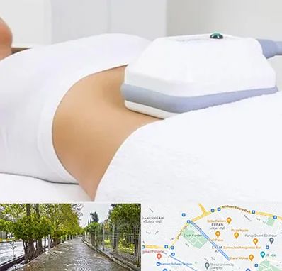 لاغری موضعی در خیابان ارم شیراز 