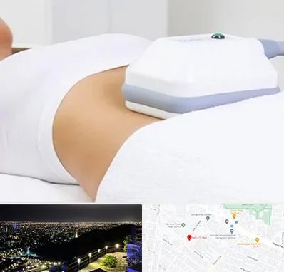 لاغری موضعی در هفت تیر مشهد 