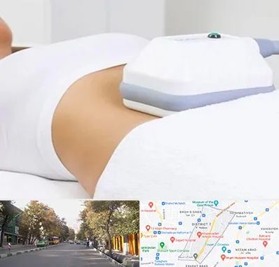 لاغری موضعی در شریعتی 