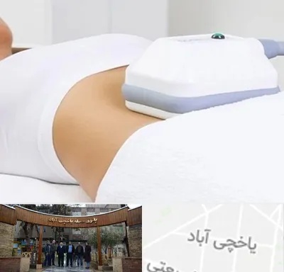 لاغری موضعی در یاخچی آباد