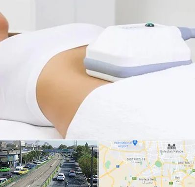 لاغری موضعی در جنوب تهران 