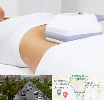 لاغری موضعی در شهران 