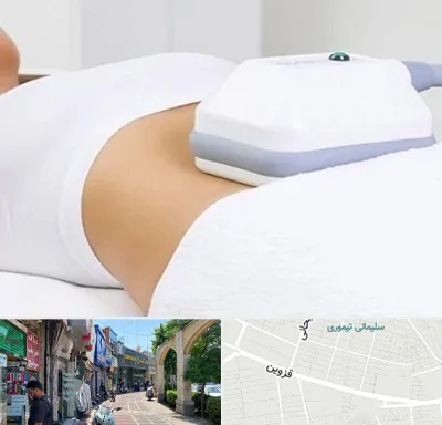 لاغری موضعی در خیابان قزوین