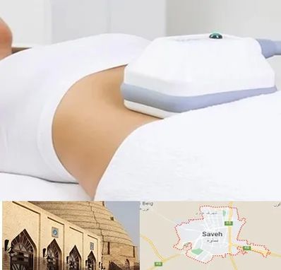 لاغری موضعی در ساوه