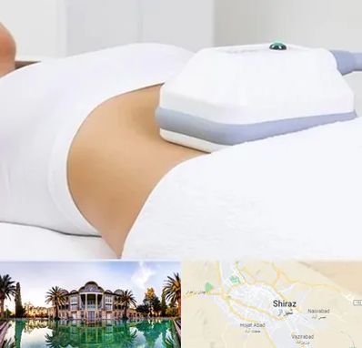 لاغری موضعی در شیراز