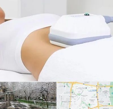 لاغری موضعی در باغ فیض 