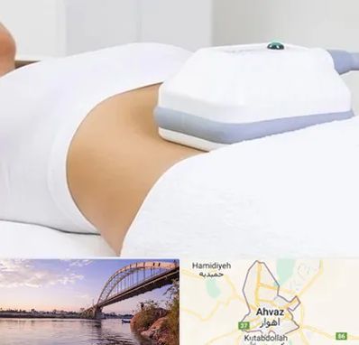 لاغری موضعی در اهواز