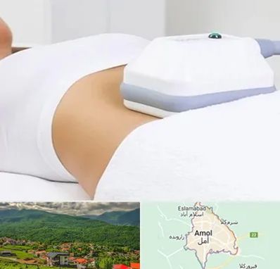 لاغری موضعی در آمل