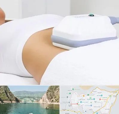 لاغری موضعی در ایلام