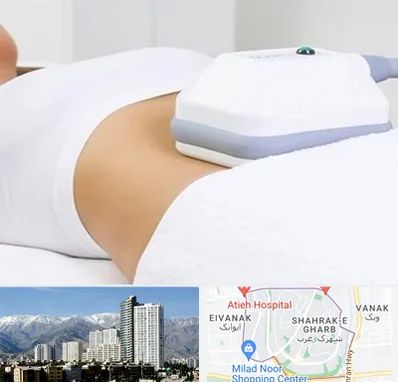 لاغری موضعی در شهرک غرب 