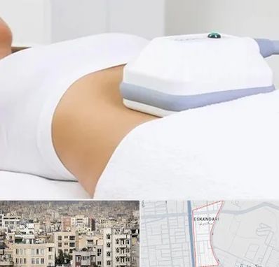 لاغری موضعی در اسکندری