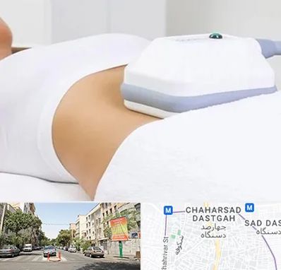 لاغری موضعی در چهارصد دستگاه 