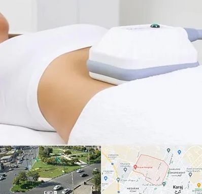 لاغری موضعی در شاهین ویلا کرج 