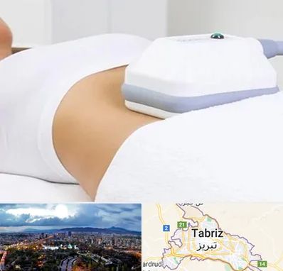 لاغری موضعی در تبریز