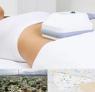 لاغری موضعی در منطقه 8 تهران 