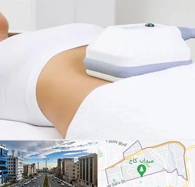 لاغری موضعی در سعادت آباد 