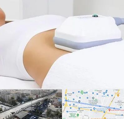 لاغری موضعی در فرجام 