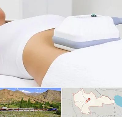 لاغری موضعی در خاش