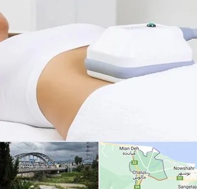 لاغری موضعی در چالوس