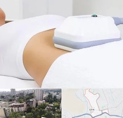 لاغری موضعی در اوین