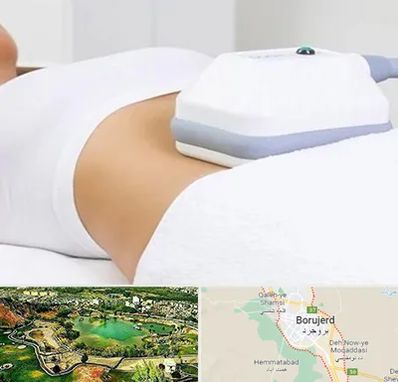 لاغری موضعی در بروجرد