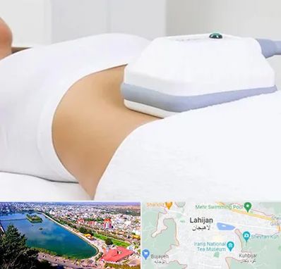 لاغری موضعی در لاهیجان