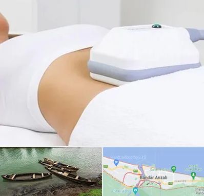 لاغری موضعی در بندر انزلی