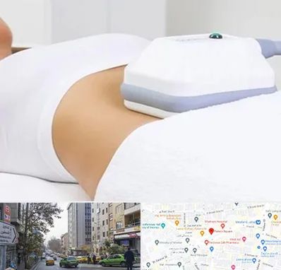 لاغری موضعی در فاطمی 