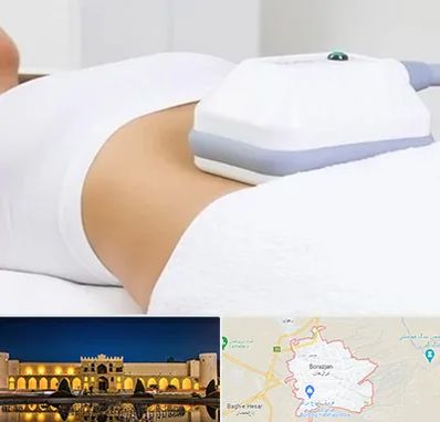 لاغری موضعی در برازجان