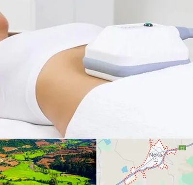 لاغری موضعی در نکا