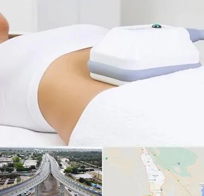 لاغری موضعی در اندیمشک