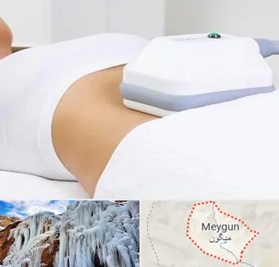 لاغری موضعی در میگون