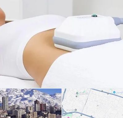 لاغری موضعی در ازگل