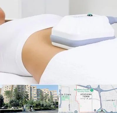 لاغری موضعی در آپادانا