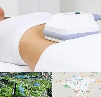 لاغری موضعی در بجنورد