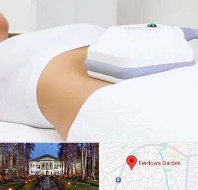 لاغری موضعی در باغ فردوس