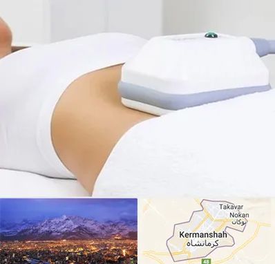 لاغری موضعی در کرمانشاه